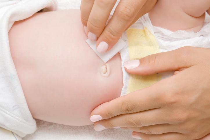 Cuidados e higiene del ombligo del bebé recién nacido